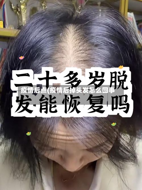 疫情后点(疫情后掉头发怎么回事)-第2张图片